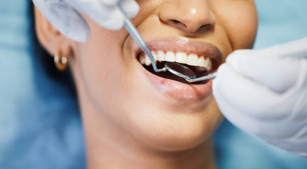Best Emergency Tooth Extraction in Holton, KS