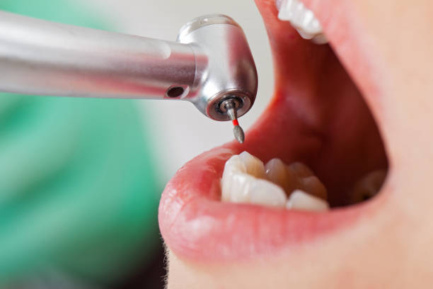 Best Pediatric Emergency Dentist in Holton, KS